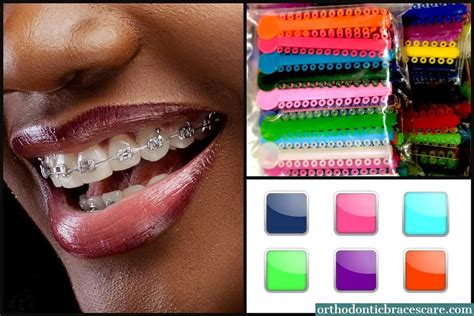 best braces color for adults.